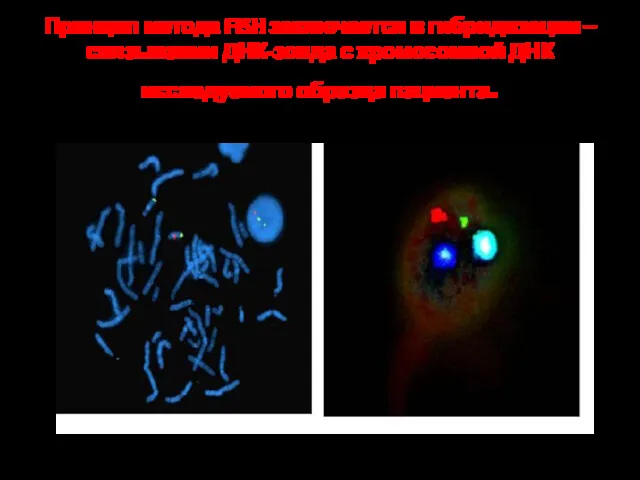 Принцип метода FISH заключается в гибридизации – связывании ДНК-зонда с