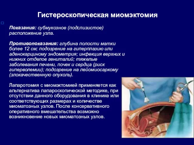 Гистероскопическая миомэктомия Показания: субмукозное (подслизистое) расположение узла. Противопоказания: глубина полости матки более 12