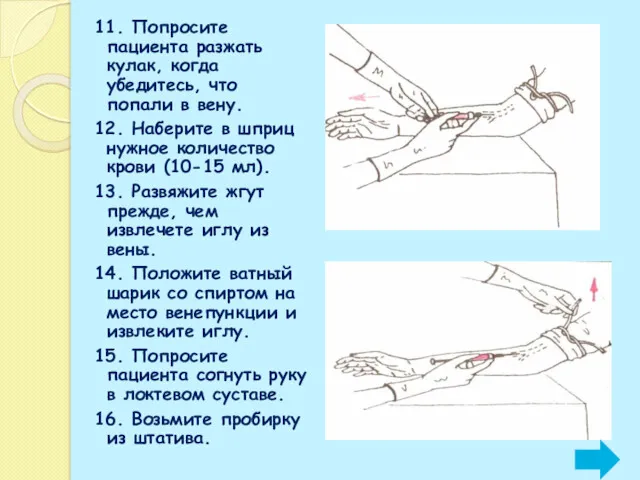 11. Попросите пациента разжать кулак, когда убедитесь, что попали в