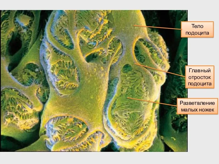 Разветвление малых ножек Главный отросток подоцита Тело подоцита
