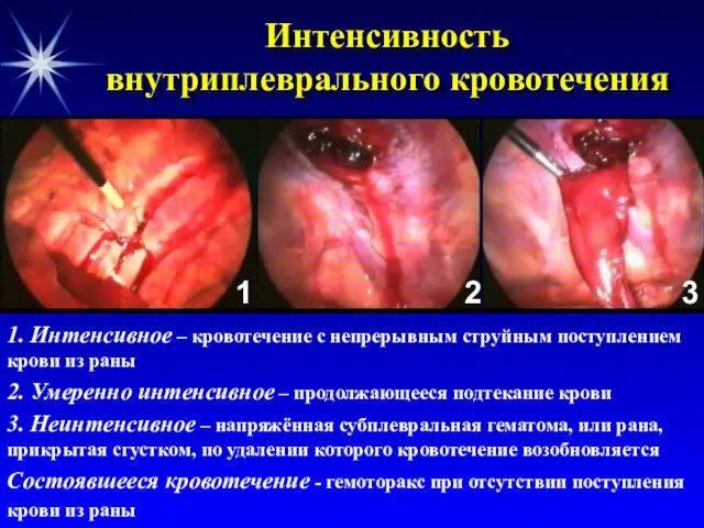 Интенсивность внутриплеврального кровотечения 1. Интенсивное – кровотечение с непрерывным струйным поступлением крови из