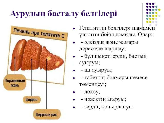 Аурудың басталу белгілері Гепатиттің белгілері шамамен үш апта бойы дамиды.