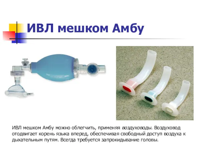 ИВЛ мешком Амбу ИВЛ мешком Амбу можно облегчить, применяя воздуховоды.