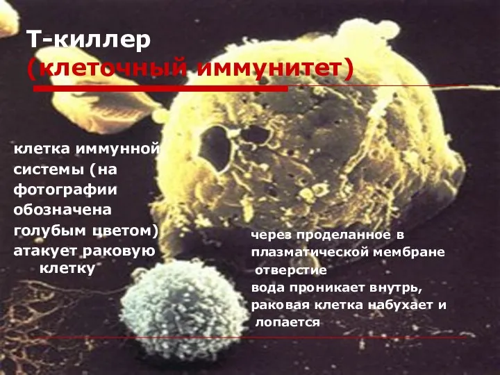 Т-киллер (клеточный иммунитет) клетка иммунной системы (на фотографии обозначена голубым цветом) атакует раковую