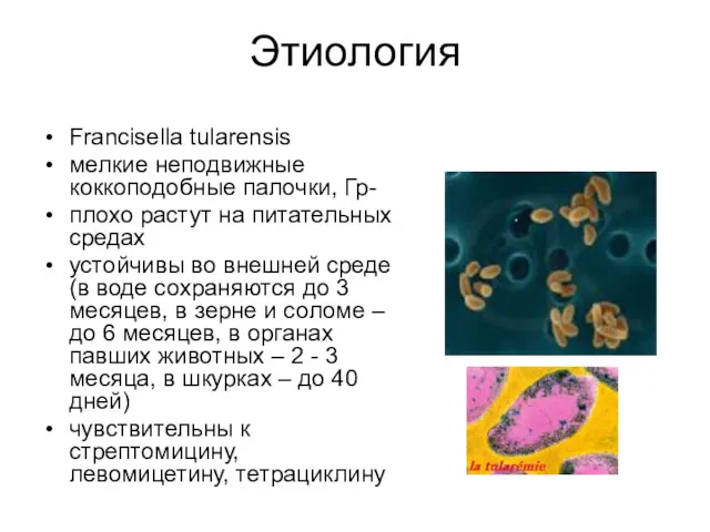 Этиология Francisella tularensis мелкие неподвижные коккоподобные палочки, Гр- плохо растут