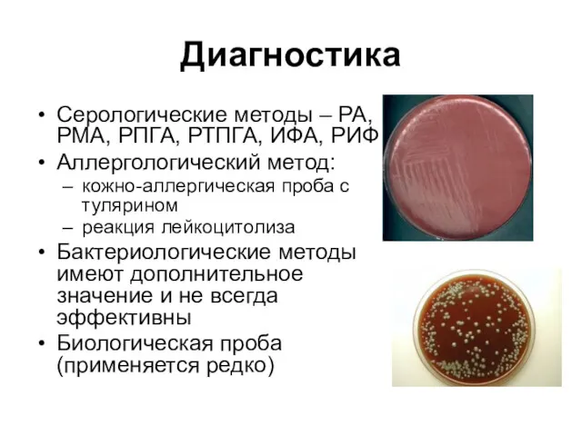 Диагностика Серологические методы – РА, РМА, РПГА, РТПГА, ИФА, РИФ