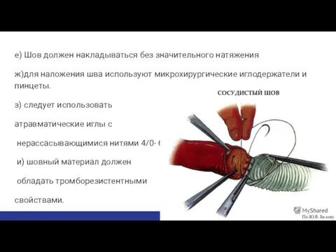 е) Шов должен накладываться без значительного натяжения ж)для наложения шва