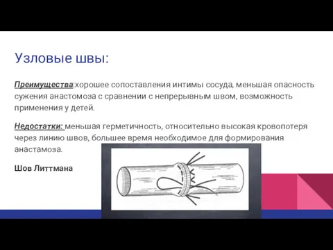 Узловые швы: Преимущества:хорошее сопоставления интимы сосуда, меньшая опасность сужения анастомоза