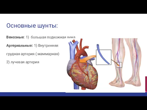 Основные шунты: Венозные: 1) большая подкожная вена Артериальные: 1) Внутренняя