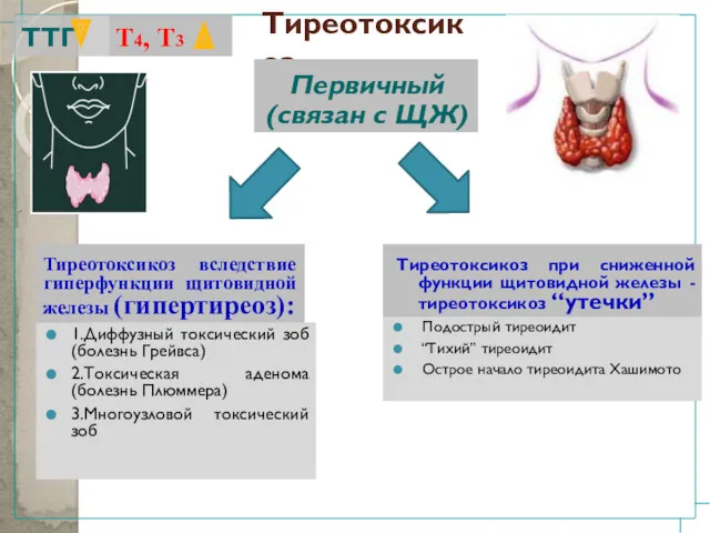 Тиреотоксикоз 1.Диффузный токсический зоб (болезнь Грейвса) 2.Токсическая аденома (болезнь Плюммера)