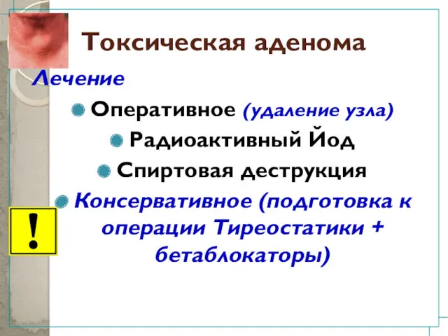 Токсическая аденома Лечение Оперативное (удаление узла) Радиоактивный Йод Спиртовая деструкция