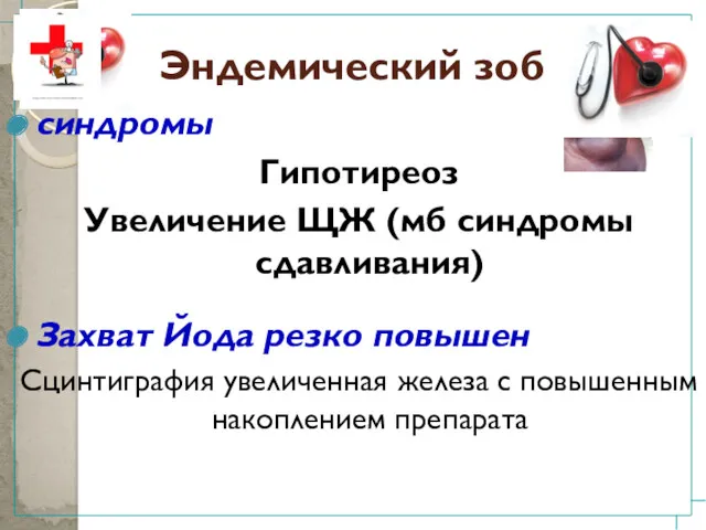 Эндемический зоб синдромы Гипотиреоз Увеличение ЩЖ (мб синдромы сдавливания) Захват Йода резко повышен