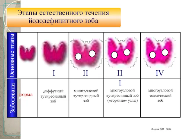 20 Фадеев В.В., 2004 Основные этапы I II III IV Заболевания норма диффузный