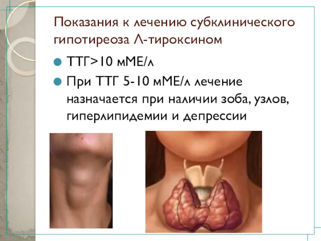 Показания к лечению субклинического гипотиреоза Л-тироксином ТТГ>10 мМЕ/л При ТТГ 5-10 мМЕ/л лечение