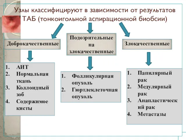 Узлы классифицируют в зависимости от результатов ТАБ (тонкоигольной аспирационной биобсии)