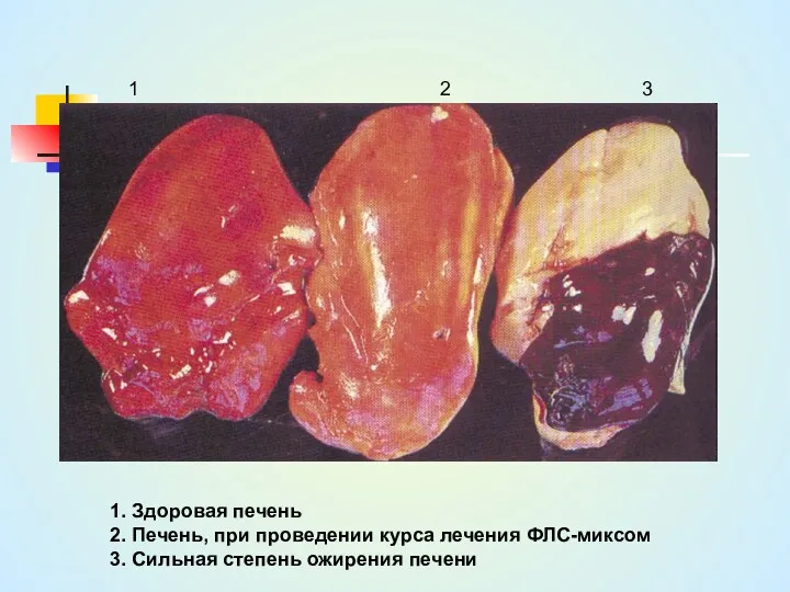 1. Здоровая печень 2. Печень, при проведении курса лечения ФЛС-миксом