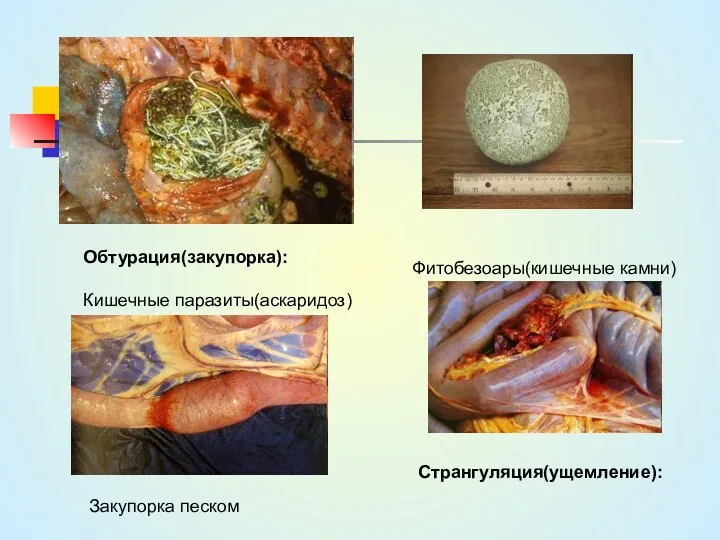 Обтурация(закупорка): Кишечные паразиты(аскаридоз) Фитобезоары(кишечные камни) Закупорка песком Странгуляция(ущемление):