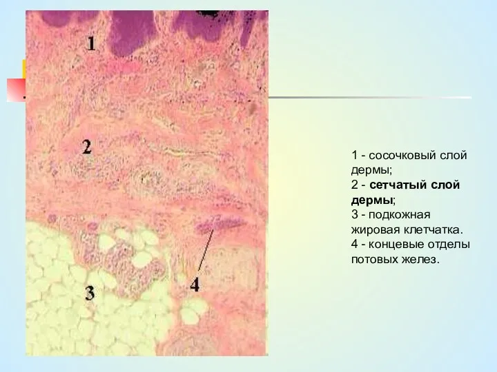 1 - сосочковый слой дермы; 2 - сетчатый слой дермы;