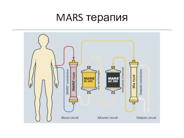 MARS терапия