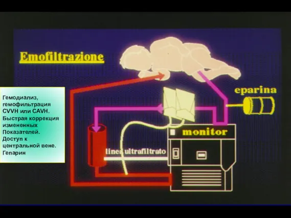 Гемодиализ, гемофильтрация CVVH или CAVH. Быстрая коррекция измененных Показателей. Доступ к центральной вене. Гепарин