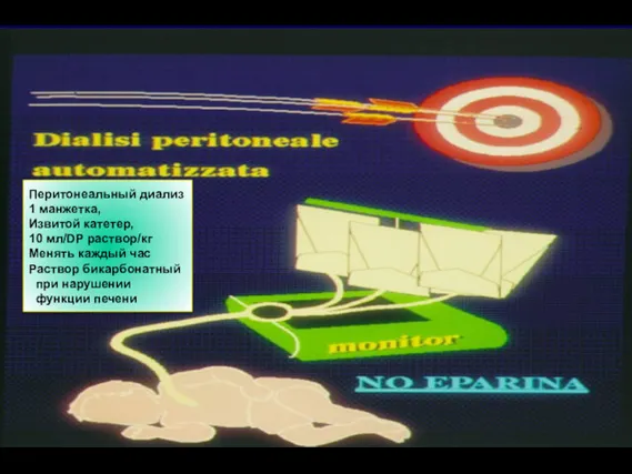 Перитонеальный диализ 1 манжетка, Извитой катетер, 10 мл/DP раствор/кг Менять каждый час Раствор