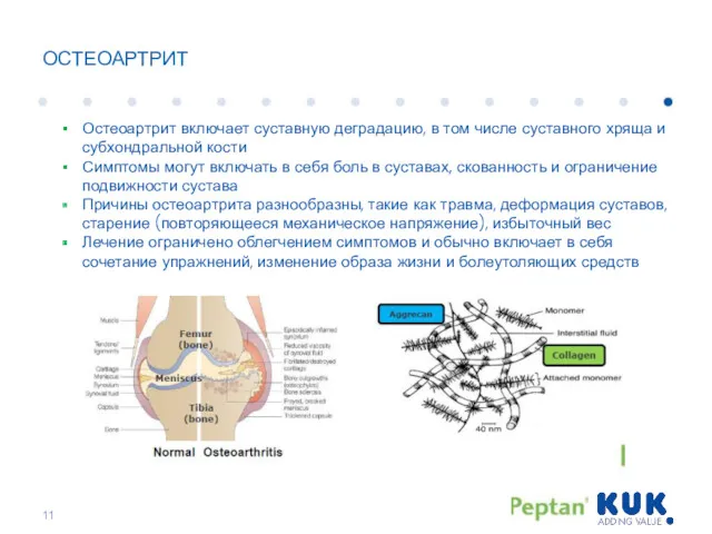 ОСТЕОАРТРИТ Остеоартрит включает суставную деградацию, в том числе суставного хряща