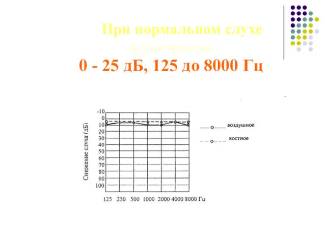 При нормальном слухе аудиограмма 0 - 25 дБ, 125 до 8000 Гц