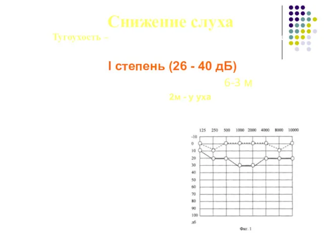 Снижение слуха Тугоухость – стойкое понижение слуха, вызывающее затруднения в