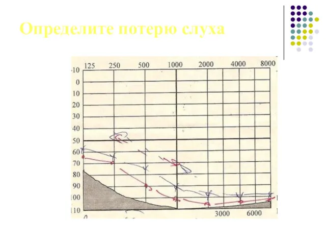 Определите потерю слуха