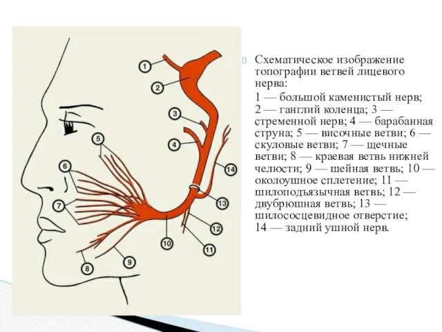 Схематическое изображение топографии ветвей лицевого нерва: 1 — большой каменистый нерв; 2 —