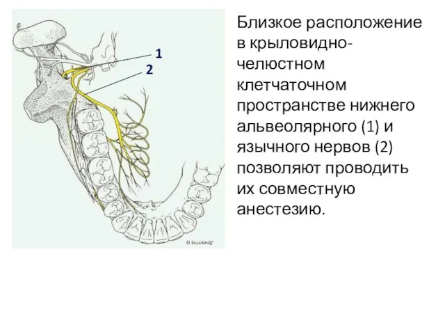 Близкое расположение в крыловидно-челюстном клетчаточном пространстве нижнего альвеолярного (1) и