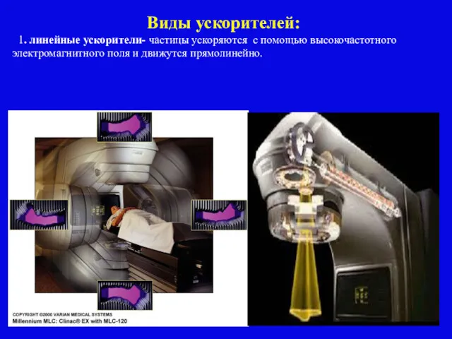 Виды ускорителей: 1. линейные ускорители- частицы ускоряются с помощью высокочастотного электромагнитного поля и движутся прямолинейно.