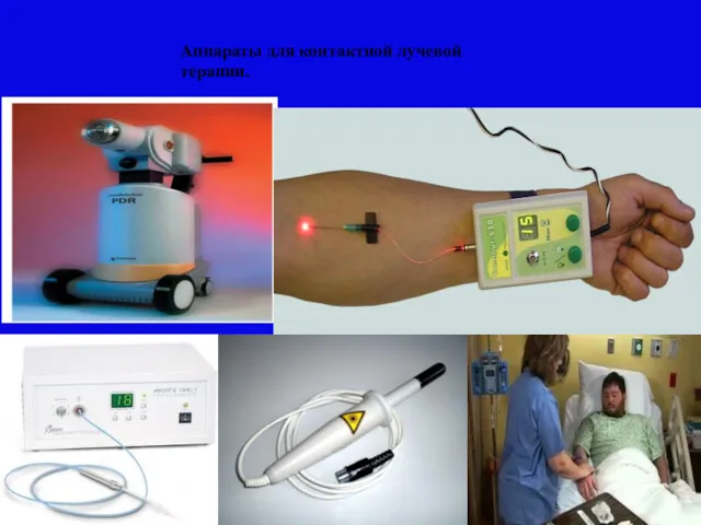 Аппараты для контактной лучевой терапии.