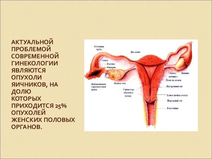 АКТУАЛЬНОЙ ПРОБЛЕМОЙ СОВРЕМЕННОЙ ГИНЕКОЛОГИИ ЯВЛЯЮТСЯ ОПУХОЛИ ЯИЧНИКОВ, НА ДОЛЮ КОТОРЫХ ПРИХОДИТСЯ 25% ОПУХОЛЕЙ ЖЕНСКИХ ПОЛОВЫХ ОРГАНОВ.