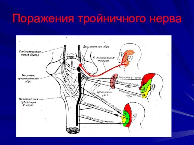 Поражения тройничного нерва