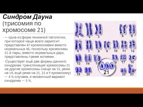 Синдро́м Да́уна (трисомия по хромосоме 21) — одна из форм