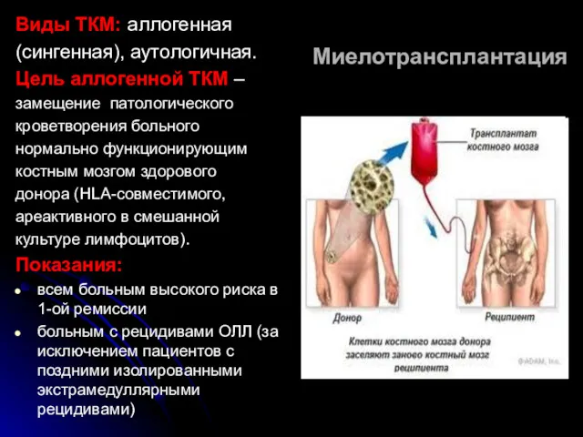 Миелотрансплантация Виды ТКМ: аллогенная (сингенная), аутологичная. Цель аллогенной ТКМ –