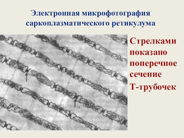 Электронная микрофотография саркоплазматического ретикулума Стрелками показано поперечное сечение Т-трубочек