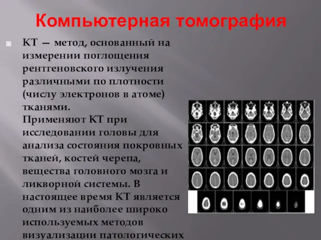 Компьютерная томография КТ — метод, основанный на измерении поглощения рентгеновского