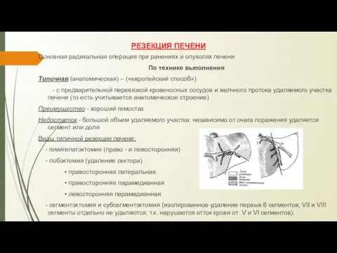 РЕЗЕКЦИЯ ПЕЧЕНИ Основная радикальная операция при ранениях и опухолях печени