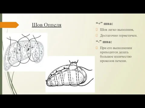 Шов Оппеля “+” шва: Шов легко выполним, Достаточно герме­тичен. “-”