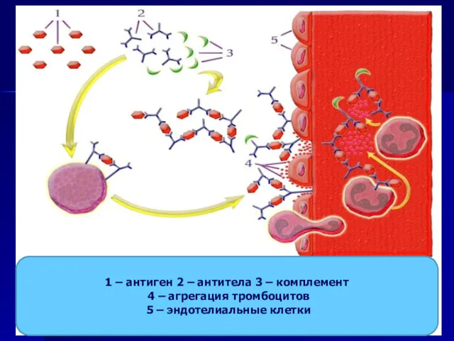 1 – антиген 2 – антитела 3 – комплемент 4