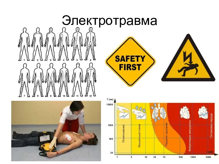 Электротравма