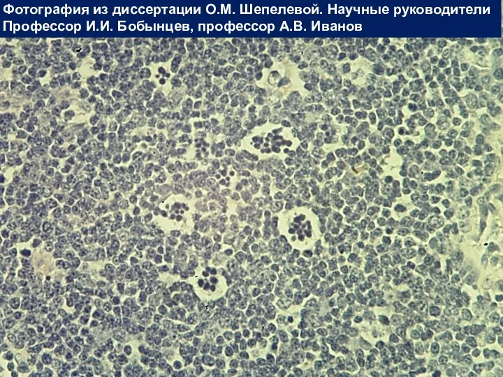 Вилочковая железа Фотография из диссертации О.М. Шепелевой. Научные руководители Профессор И.И. Бобынцев, профессор А.В. Иванов