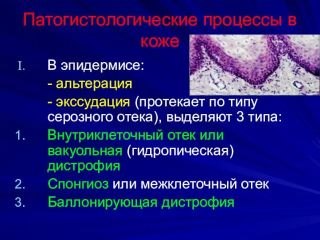Патогистологические процессы в коже В эпидермисе: - альтерация - экссудация (протекает по типу