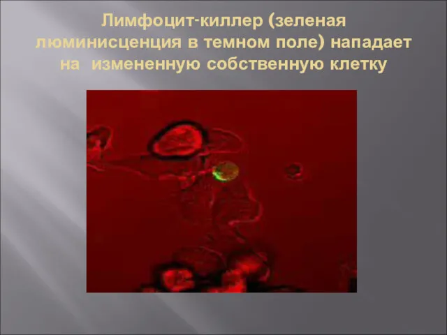 Лимфоцит-киллер (зеленая люминисценция в темном поле) нападает на измененную собственную клетку