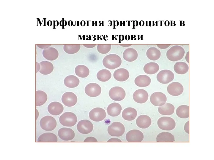 Морфология эритроцитов в мазке крови