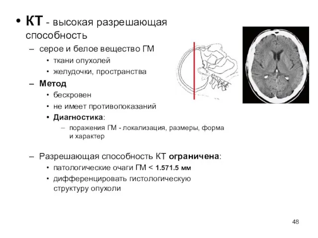 КТ - высокая разрешающая способность серое и белое вещество ГМ