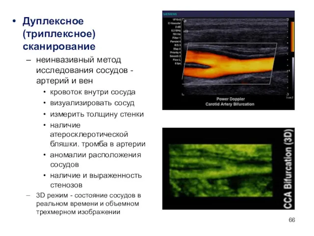 Дуплексное (триплексное) сканирование неинвазивный метод исследования сосудов - артерий и