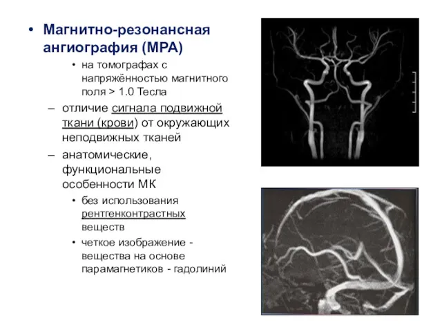 Магнитно-резонансная ангиография (МРА) на томографах с напряжённостью магнитного поля >